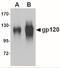 HIV gp120 antibody, NBP2-41090, Novus Biologicals, Western Blot image 
