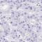 TIFA Inhibitor antibody, HPA049372, Atlas Antibodies, Immunohistochemistry paraffin image 