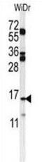 Tubulin Polymerization Promoting Protein Family Member 3 antibody, PA5-24925, Invitrogen Antibodies, Western Blot image 