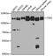 DNA Topoisomerase I antibody, GTX64445, GeneTex, Western Blot image 