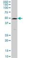 Transmembrane Serine Protease 11B antibody, H00132724-B01P, Novus Biologicals, Western Blot image 