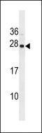 Synaptogyrin 1 antibody, LS-C161641, Lifespan Biosciences, Western Blot image 