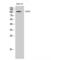 EPH Receptor A3 antibody, LS-C383364, Lifespan Biosciences, Western Blot image 