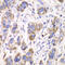 Aldehyde Dehydrogenase 2 Family Member antibody, 14-336, ProSci, Immunohistochemistry paraffin image 