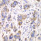 Aldehyde dehydrogenase, mitochondrial antibody, 14-336, ProSci, Immunohistochemistry paraffin image 