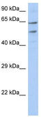 Transmembrane And Coiled-Coil Domain Family 3 antibody, TA338431, Origene, Western Blot image 