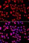 ASPSCR1 Tether For SLC2A4, UBX Domain Containing antibody, LS-C349178, Lifespan Biosciences, Immunofluorescence image 