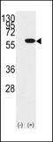 Y-Box Binding Protein 1 antibody, LS-C100023, Lifespan Biosciences, Western Blot image 