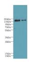 Ubiquitin Conjugating Enzyme E2 O antibody, LS-C379446, Lifespan Biosciences, Western Blot image 