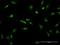 Neuronal Vesicle Trafficking Associated 1 antibody, H00027065-M03, Novus Biologicals, Immunofluorescence image 