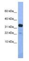 Kelch Domain Containing 9 antibody, NBP1-79471, Novus Biologicals, Western Blot image 