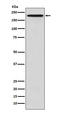 Eukaryotic Translation Initiation Factor 2 Alpha Kinase 4 antibody, M01172, Boster Biological Technology, Western Blot image 