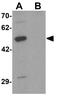 Decapping MRNA 2 antibody, GTX31499, GeneTex, Western Blot image 