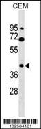 Calcium Voltage-Gated Channel Auxiliary Subunit Gamma 3 antibody, 59-718, ProSci, Western Blot image 