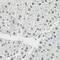 Elongin C antibody, GTX65577, GeneTex, Immunohistochemistry paraffin image 
