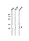 Cyclin Dependent Kinase 2 antibody, M00166-1, Boster Biological Technology, Western Blot image 