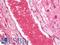 Fms Related Tyrosine Kinase 4 antibody, LS-B10499, Lifespan Biosciences, Immunohistochemistry frozen image 
