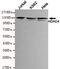 Histone Deacetylase 4 antibody, GTX49181, GeneTex, Western Blot image 