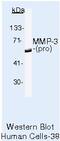 Matrix Metallopeptidase 3 antibody, MA5-14199, Invitrogen Antibodies, Western Blot image 