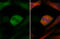 Checkpoint Kinase 1 antibody, GTX70303, GeneTex, Immunocytochemistry image 