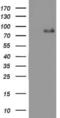 Angiotensin I Converting Enzyme 2 antibody, NBP2-72117, Novus Biologicals, Western Blot image 