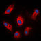 Involucrin antibody, LS-C352399, Lifespan Biosciences, Immunofluorescence image 