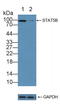 Signal Transducer And Activator Of Transcription 5B antibody, LS-C372804, Lifespan Biosciences, Western Blot image 
