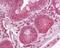 Regulatory Associated Protein Of MTOR Complex 1 antibody, PA1-41269, Invitrogen Antibodies, Immunohistochemistry paraffin image 