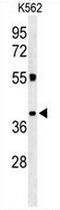 Immune receptor expressed on myeloid cells 1 antibody, AP50968PU-N, Origene, Western Blot image 