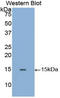 Galactosidase Alpha antibody, LS-C302197, Lifespan Biosciences, Western Blot image 