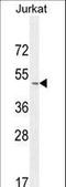 P-selectin glycoprotein ligand 1 antibody, LS-C168946, Lifespan Biosciences, Western Blot image 