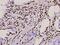 T-Box 15 antibody, PA5-36143, Invitrogen Antibodies, Immunohistochemistry frozen image 