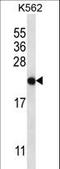 ChaC Cation Transport Regulator Homolog 2 antibody, LS-C159341, Lifespan Biosciences, Western Blot image 