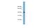 Beta-1,4-Galactosyltransferase 2 antibody, A10774, Boster Biological Technology, Western Blot image 