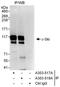 Ski oncogene antibody, A303-517A, Bethyl Labs, Immunoprecipitation image 