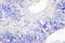 Transforming Growth Factor Alpha antibody, LS-C176240, Lifespan Biosciences, Immunohistochemistry frozen image 