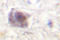 APC Regulator Of WNT Signaling Pathway antibody, LS-C176383, Lifespan Biosciences, Immunohistochemistry paraffin image 