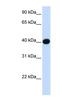 Lipoic Acid Synthetase antibody, NBP1-54319, Novus Biologicals, Western Blot image 