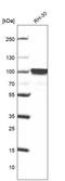 Forkhead Box P2 antibody, NBP1-86671, Novus Biologicals, Western Blot image 