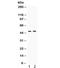 Inhibitor Of Growth Family Member 1 antibody, R32348, NSJ Bioreagents, Western Blot image 