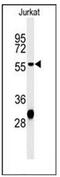 Hydroxyacyl-CoA Dehydrogenase Trifunctional Multienzyme Complex Subunit Beta antibody, AP51996PU-N, Origene, Western Blot image 