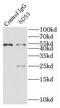 TPD52 Like 1 antibody, FNab03791, FineTest, Immunoprecipitation image 