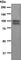 ADAM Metallopeptidase Domain 15 antibody, ab124698, Abcam, Western Blot image 