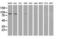 Protein Kinase C Epsilon antibody, LS-C172750, Lifespan Biosciences, Western Blot image 