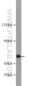 Lysine-specific demethylase 4A antibody, 24943-1-AP, Proteintech Group, Western Blot image 