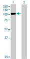 OCRL Inositol Polyphosphate-5-Phosphatase antibody, H00004952-B01P, Novus Biologicals, Western Blot image 