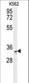 Aldo-Keto Reductase Family 1 Member C3 antibody, LS-C156217, Lifespan Biosciences, Western Blot image 