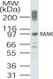 TNF Receptor Superfamily Member 11a antibody, 49-328, ProSci, Western Blot image 