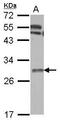 Thymidine Kinase 1 antibody, PA5-29686, Invitrogen Antibodies, Western Blot image 