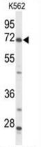Acyl-CoA Synthetase Short Chain Family Member 2 antibody, AP50064PU-N, Origene, Western Blot image 